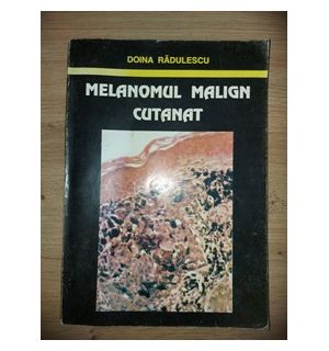 Melanomul malign cutanat- Doina Radulescu