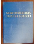 Morfopatologia tuberculozei