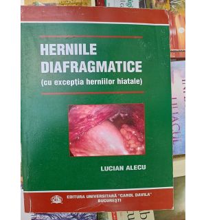 Herniile diafragmatice (cu exceptia herniilor hiatale)- Lucian Alecu
