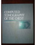 Computed Tomography of the Chest- J.David Godwin