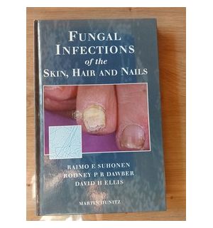 Fungal infecctions of the skin, hair and nails- Raimo F. Suhonen, Rodney P. R. Dawber