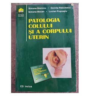 Patologia copilului si a corpului uterin- Simona Stoinicu, Doinita Radulescu