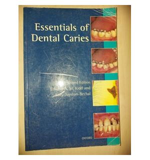 Essentials of dental caries