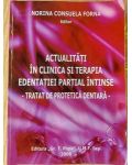 Actualitati in clinica si terapia edentatiei partial intinse- Norina Consuela Forna