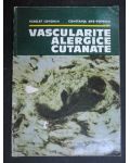 Vascularite alergice cutanate