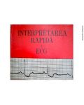 Interpretarea rapida a ECG