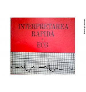 Interpretarea rapida a ECG